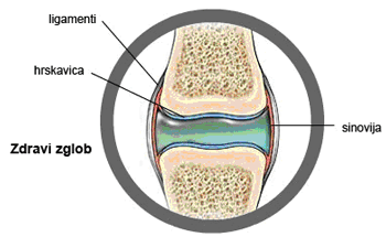 http://www.cybermed.hr/var/cybermed/storage/images/media/images/ra1x/930303-1-cro-HR/ra1x.gif