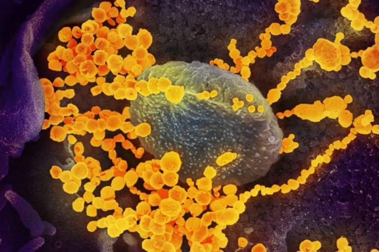 Novi koronavirus može se širiti u vrućim i vlažnim uvjetima