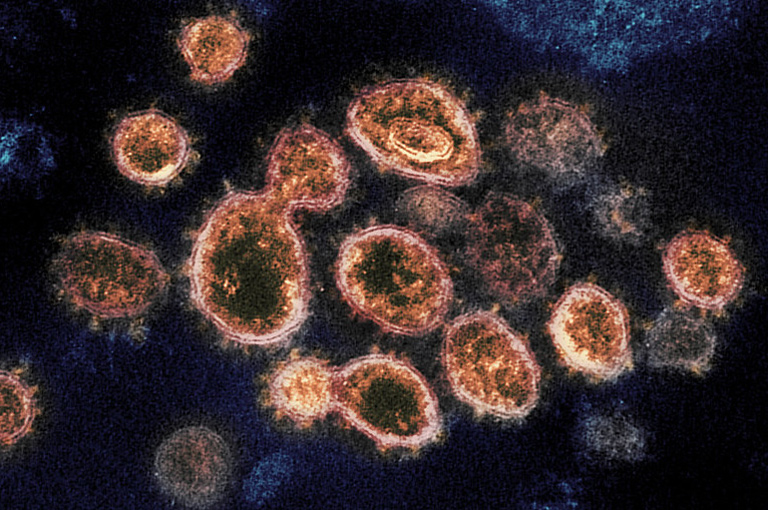 Oko 20 posto zaraženih sa SARS-CoV-2 nema simptome bolesti