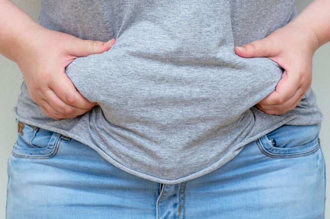 Pretilost povezana s povećanim rizikom od Crohnove bolesti