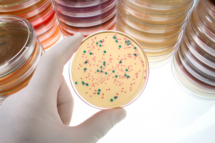 Toksin bakterije Clostridium perfringens potencijalni okidač multiple skleroze