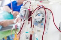 Transplantacija bubrega inficiranog hepatitisom C sigurna Transplantacija bubrega inficiranog hepatitisom C sigurna