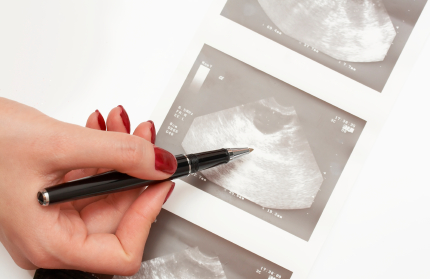 Dijagnosticiranje raka jajnika