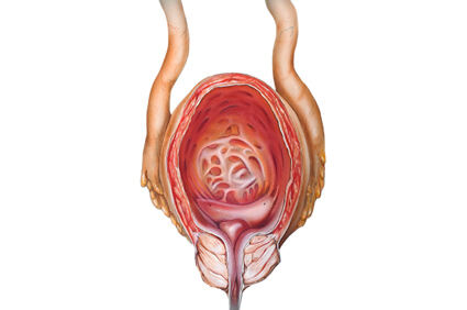 Rak prostate - osnovne karakteristike bolesti