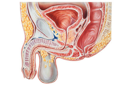 Znakovi i simptomi raka prostate