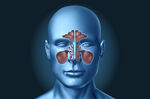 Sinusitis