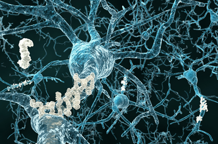 hipertenzija i alzheimerova bolest