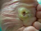 06072004_bioptron_2