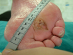 06072004_bioptron_3
