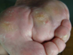 06072004_bioptron_4