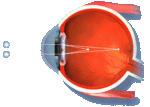 Astigmatizam