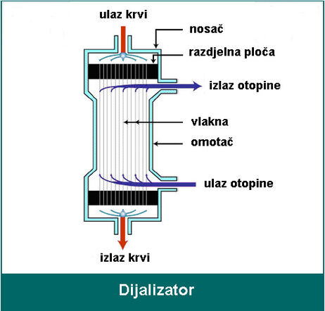 dijaliza8