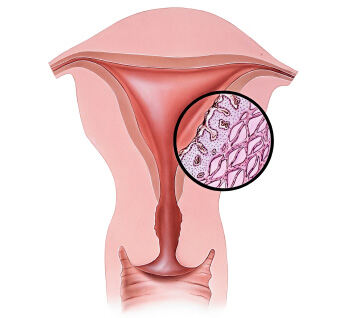 menstruacija-2b