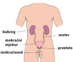 rak-bubrega-1a