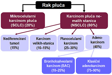 rak pluca2