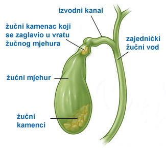 zucni-kamenac-1