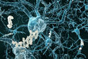 Amiloidni plakovi mogu usporiti protok krvi u mozgu