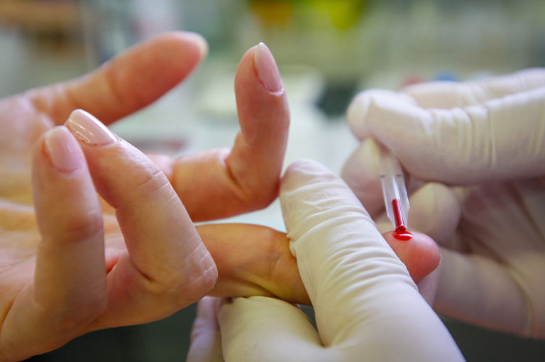 Anemija u ranoj trudnoći povezana s većim rizikom od srčanih mana u novorođenčadi