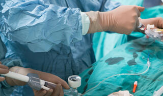 Angioplastika poboljšava simptome kod pacijenata s kroničnom potpunom koronarnom okluzijom