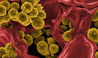 Antihipertenziv obećava protiv MRSA-e otporne na antibiotike