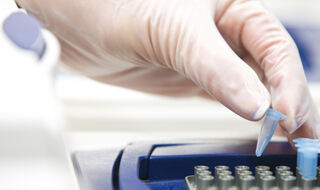 Atipična mutacija pruža priliku za personalizirano liječenje raka gušterače