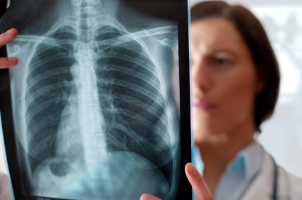 Bolesti pluća odgovorne za svaki deseti smrtni slučaj u Europi