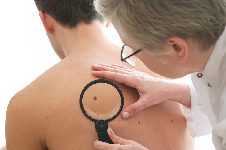 Brigom za zdravlje kože možemo smanjiti rizik od melanoma 