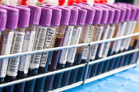 CancerSEEK: Krvni test koji otkriva osam čestih karcinoma