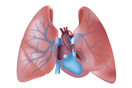 Ciljana terapija može ublažiti tešku plućnu hipertenziju