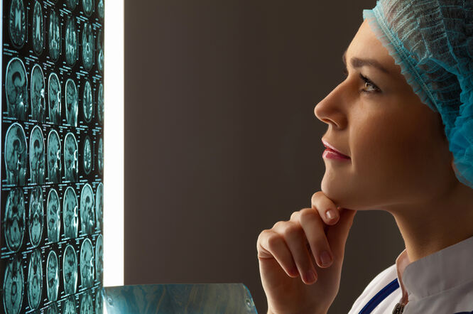 Ciljanje ADAR1 pruža novu nadu za uspješno liječenje glioblastoma