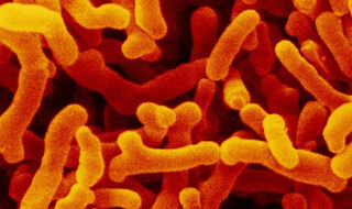 Crijevne bakterije mogu uzrokovati rijetke alergije na hranu kod djece