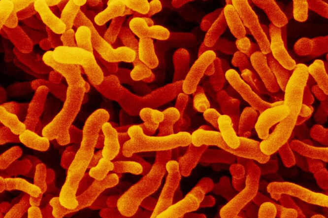 Crijevne bakterije mogu uzrokovati rijetke alergije na hranu kod djece