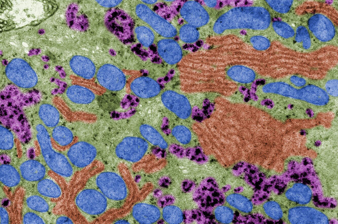 Disfunkcionalni mitohondriji dokazano potiču pojavu Parkinsonove bolesti