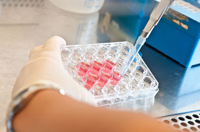 Epstein-Barr virus izaziva upalnu smrt stanica kod ulceroznog kolitisa