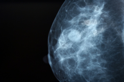 Folna kiselina povezana s rastom stanica raka dojke