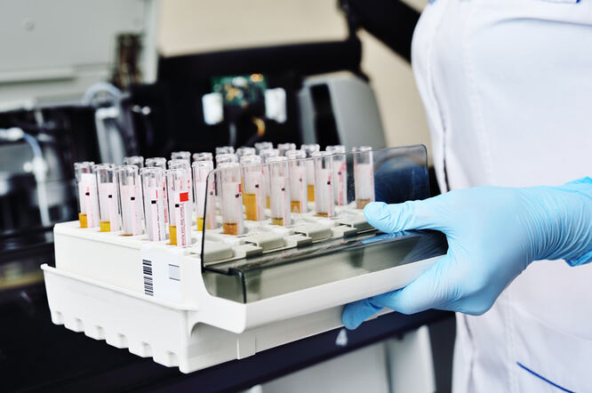Genomski test urina točno predviđa rak mokraćnog mjehura