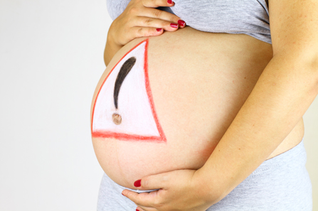 Gestacijski dijabetes predstavlja zdravstveni rizik za majku i dijete