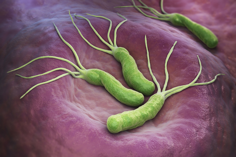 Helicobacter pylori također povezan i s rakom debelog crijeva