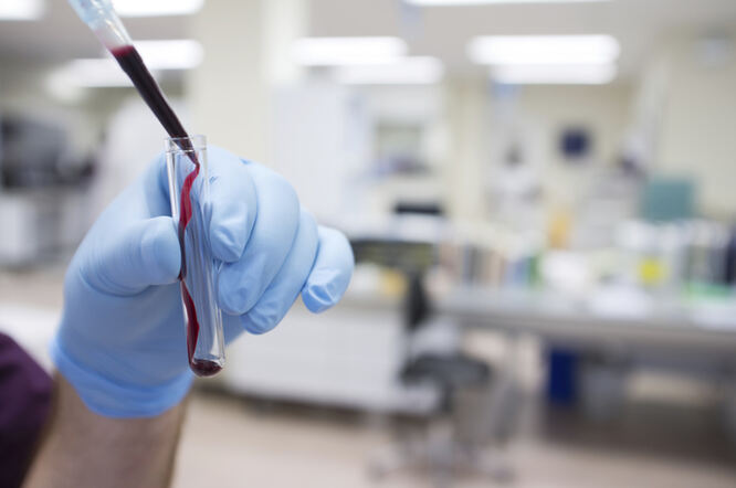Hormonski potpis mogao bi transformirati dijagnozu endometrioze