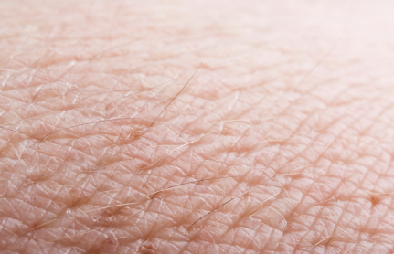 HPV povezan s razvojem raka kože