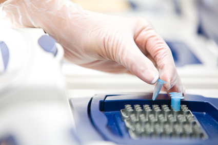 HPV test uspješniji od Papa testa u procjeni rizika od raka vrata maternice 
