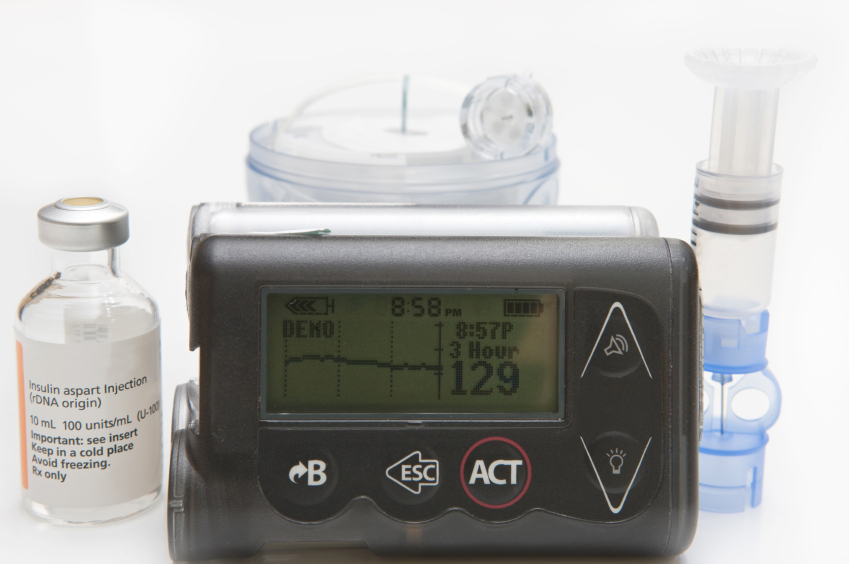 HZZO osigurao 110 inzulinskih pumpi za oboljele od dijabetesa 
