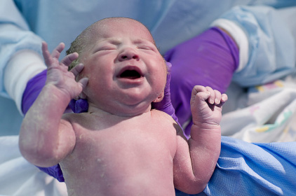 Inducirani porod povezan s većim rizicima za prvorotkinje 