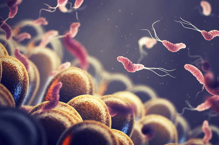 Infekcija s Helicobacter pylori negativno utječe na genetski povećan rizik za rak želuca