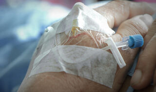 Intravensko željezo pokazuje sigurne i korisne ishode za pacijente s bakterijskom infekcijom i anemijom