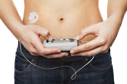 Inzulinska pumpa može smanjiti rizik od smrti od srčane bolesti 