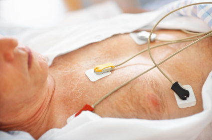 Iznenadna srčana smrt češća u muškaraca sa sporijom provodljivošću električnih impulsa kroz srce