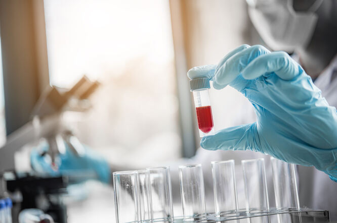 Je li Alzheimerova bolest češća nego što se prije mislilo?