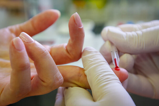 Jednostavan test krvi mogao bi lako otkriti epileptičke napadaje