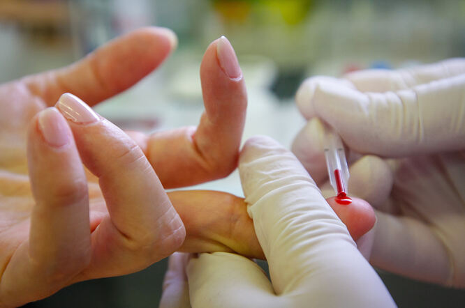 Jednostavan test krvi poboljšava predviđanje rizika od srčanog i moždanog udara